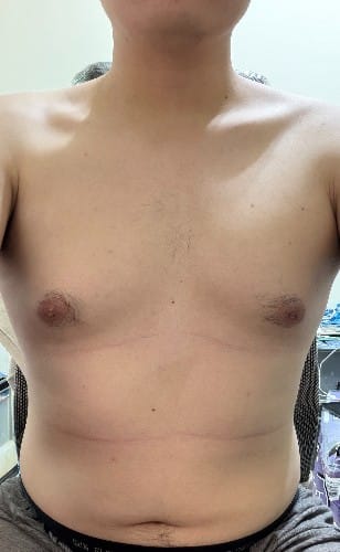 阿哇