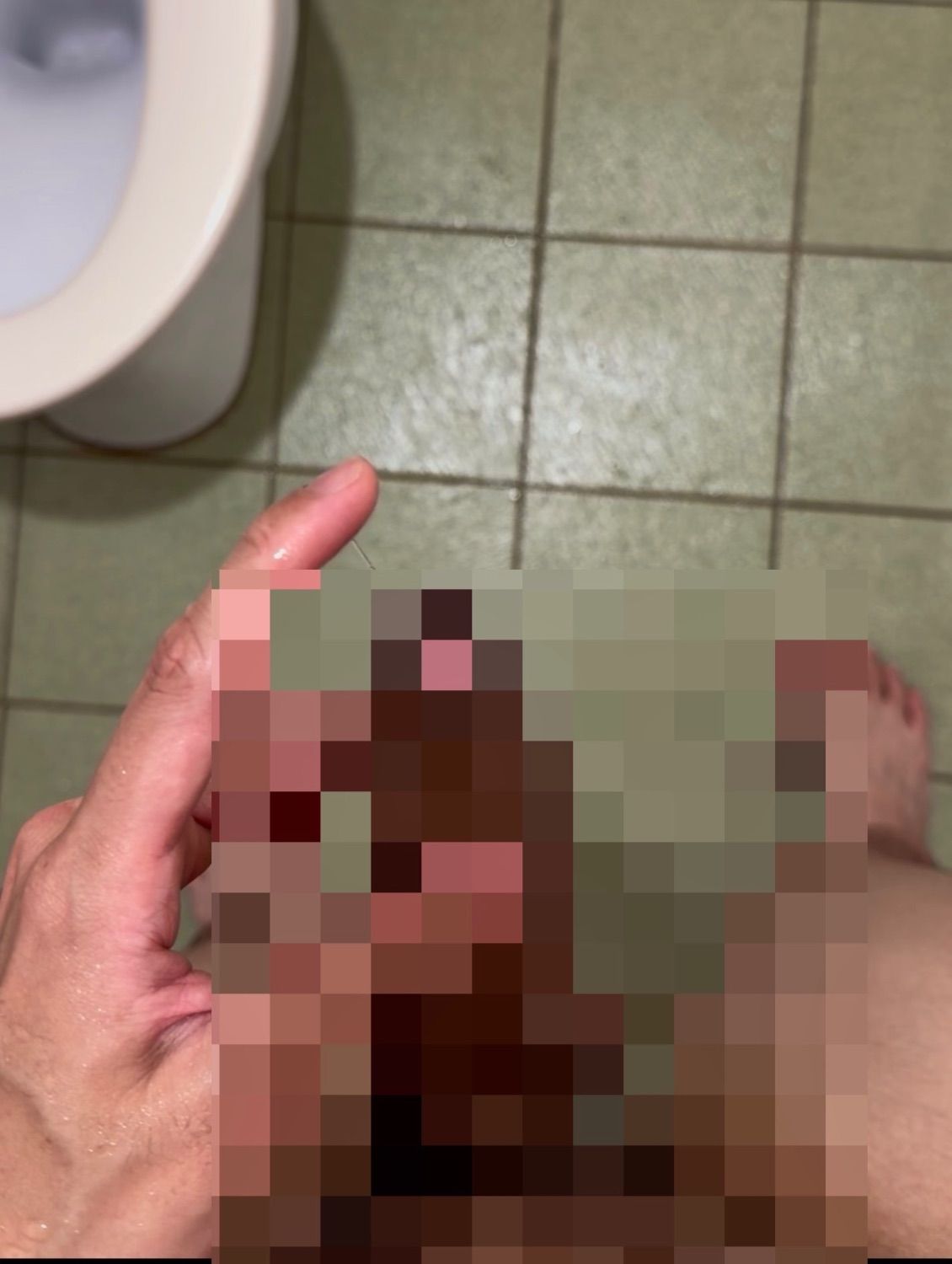 置頂
