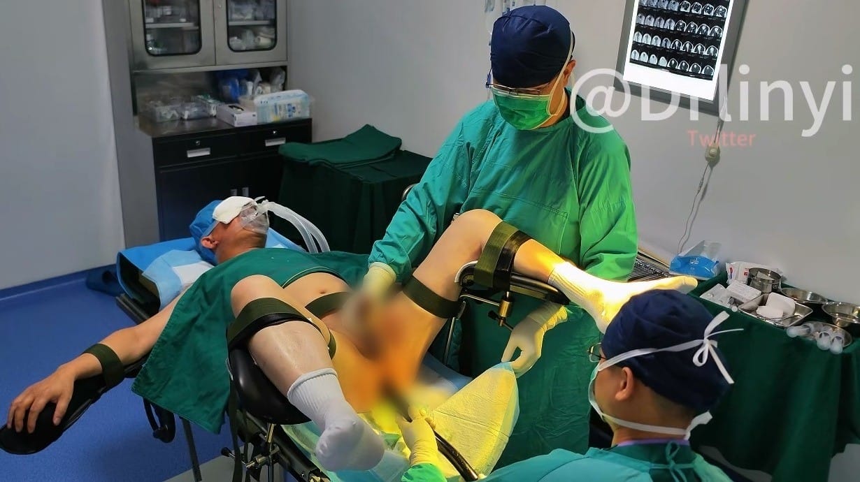 西裝黑襪大叔性成癮晚期安排手術治療噴射三次（系列二30分鐘）